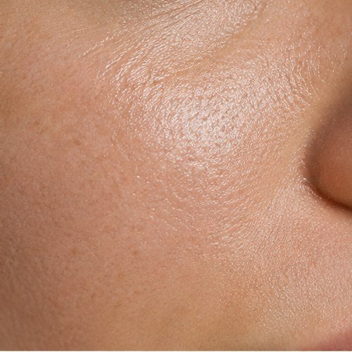 Peeling de Diamante
